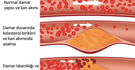 Düşük Kolesterolün Önemi